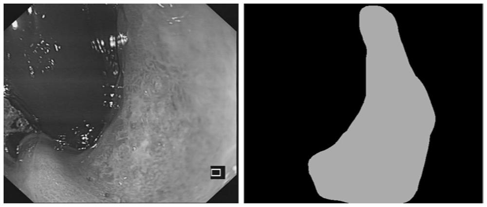 Gastroscopy video-based real-time image segmentation method, system and device