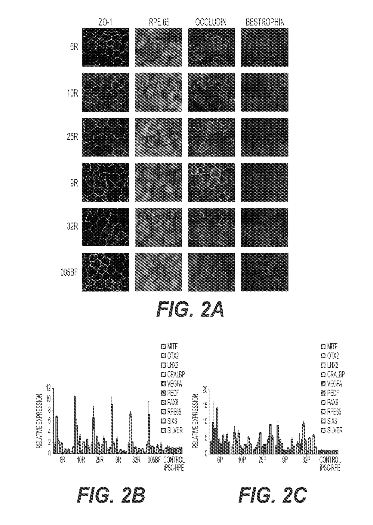 Compositions and methods for the diagnosis and treatment of age-related macular degeneration