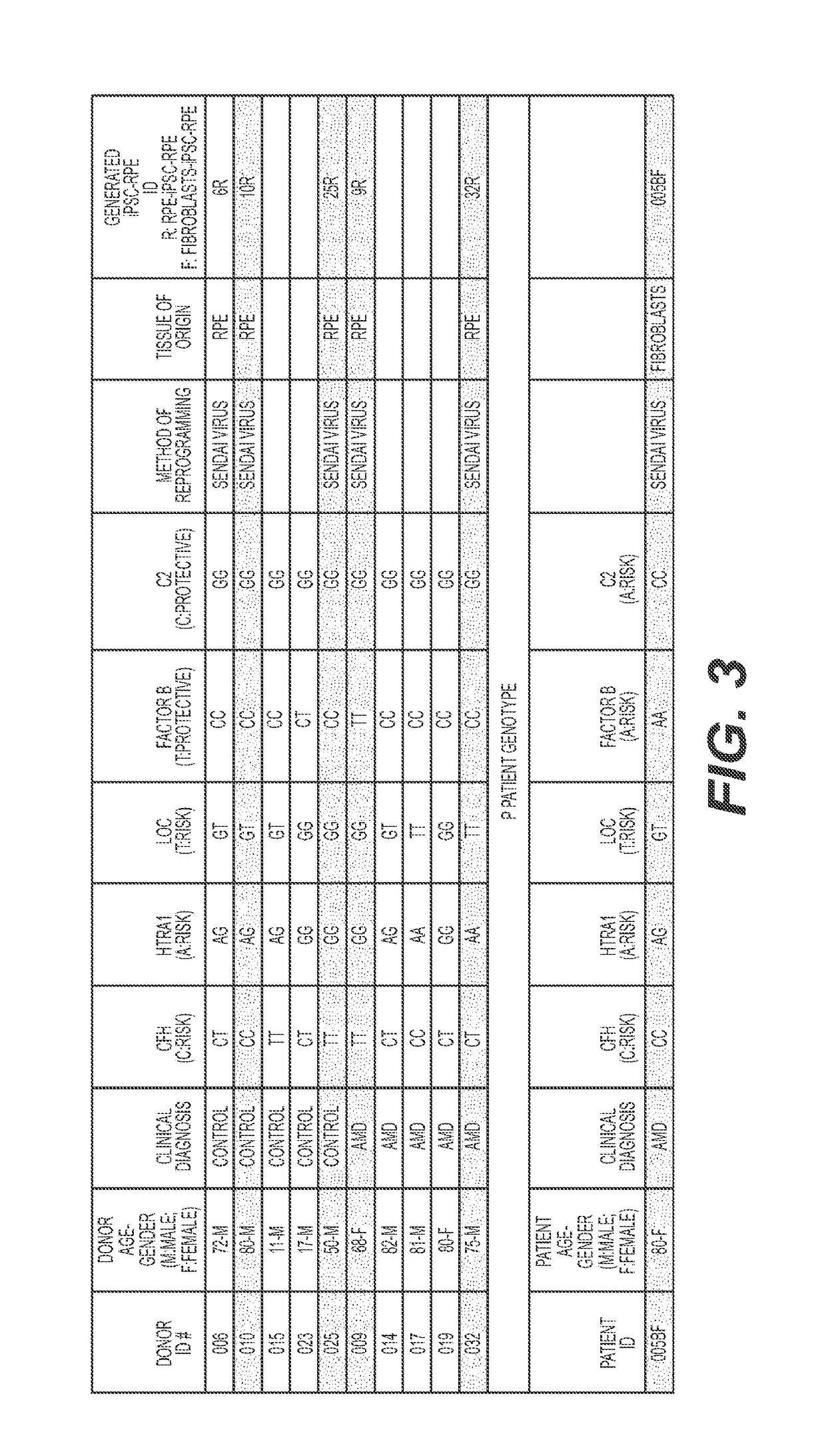 Compositions and methods for the diagnosis and treatment of age-related macular degeneration