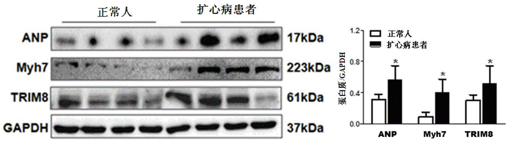 Function and application of three-domain protein 8 (trim8) inhibitor in inhibiting cardiac hypertrophy