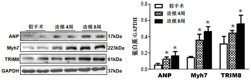 Function and application of three-domain protein 8 (trim8) inhibitor in inhibiting cardiac hypertrophy