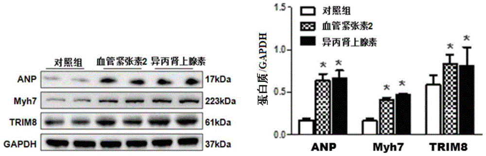 Function and application of three-domain protein 8 (trim8) inhibitor in inhibiting cardiac hypertrophy