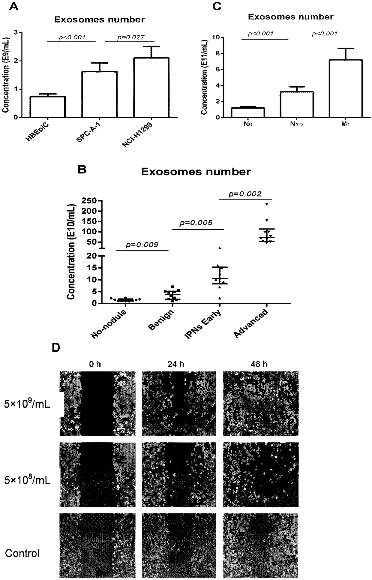 Application of exosome to diagnosis, treatment and prognosis evaluation of tumors