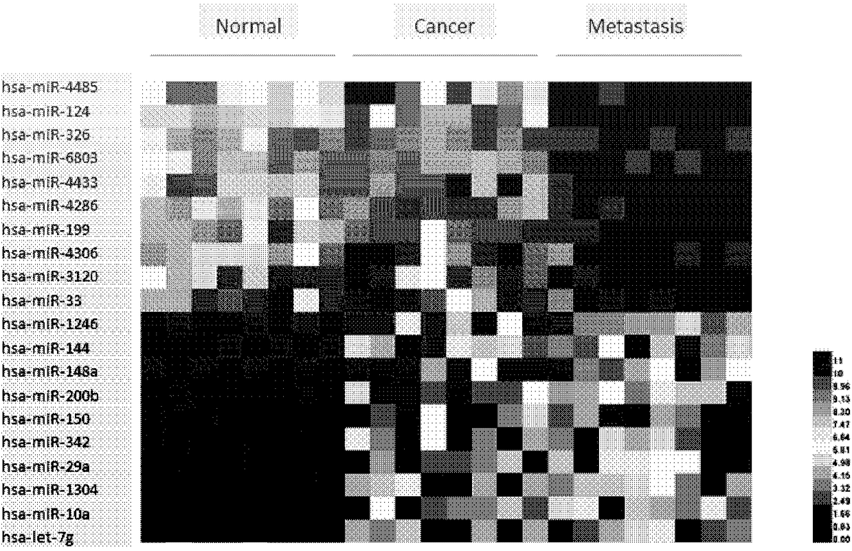 Application of exosome to diagnosis, treatment and prognosis evaluation of tumors