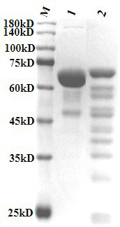 Compound composition containing recombinant collagen as well as preparation method and application of compound composition