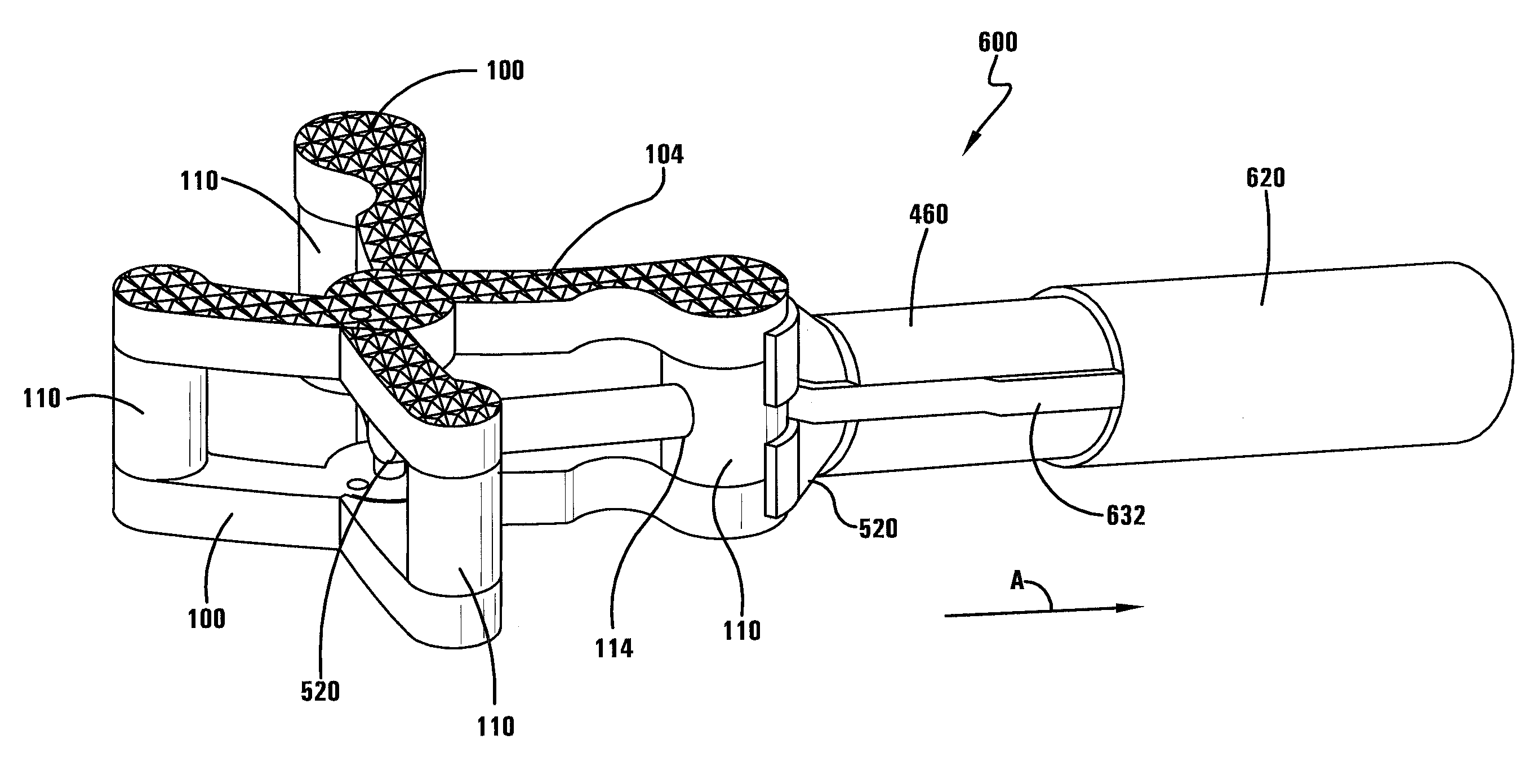 Spine surgery method and inserter