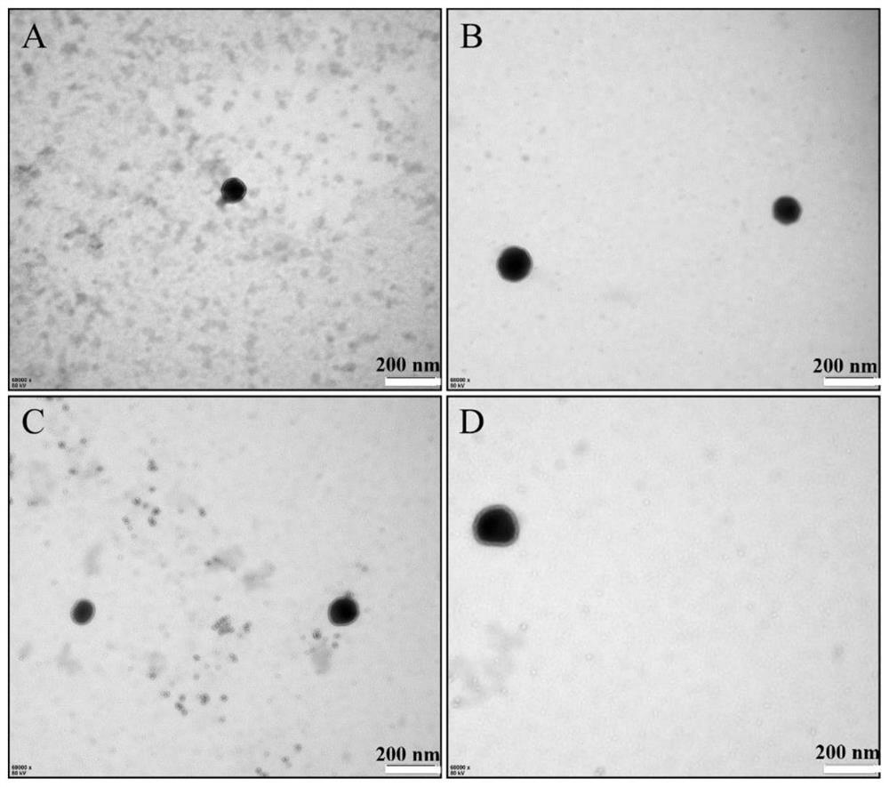 Composite liposome for improving brain cognitive memory and neuroinflammation and preparation method thereof