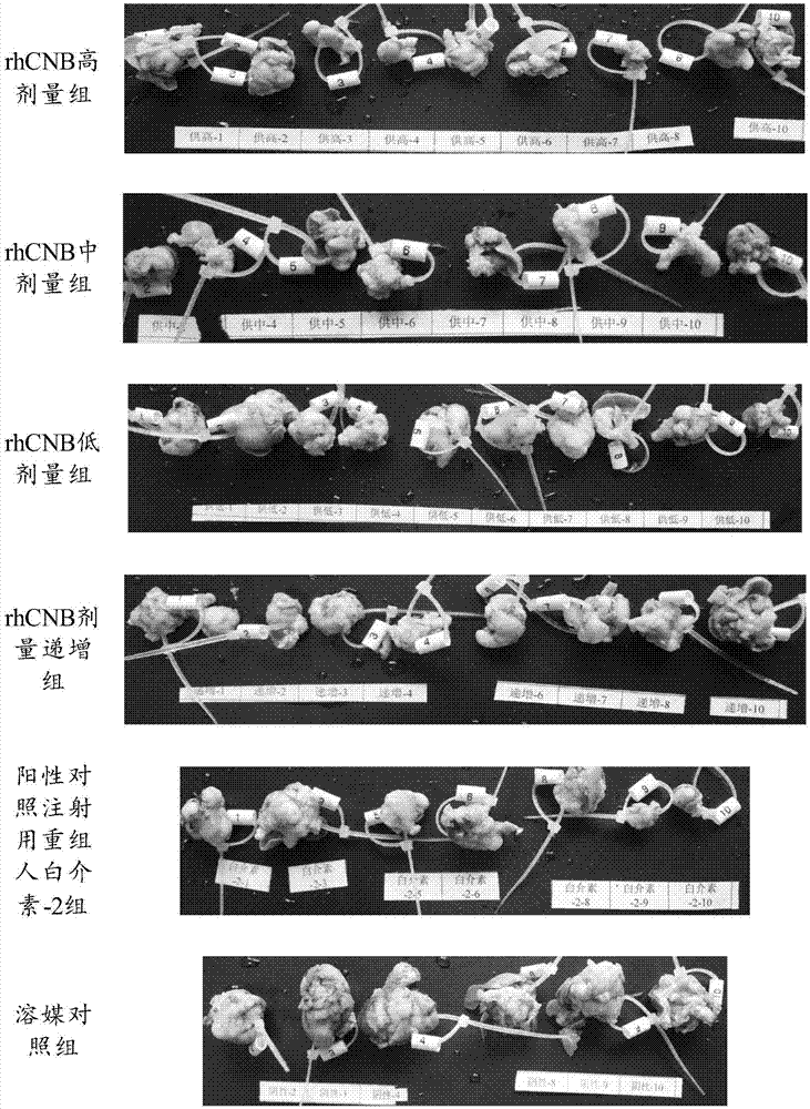 Application of recombinant human calcineurin B subunit