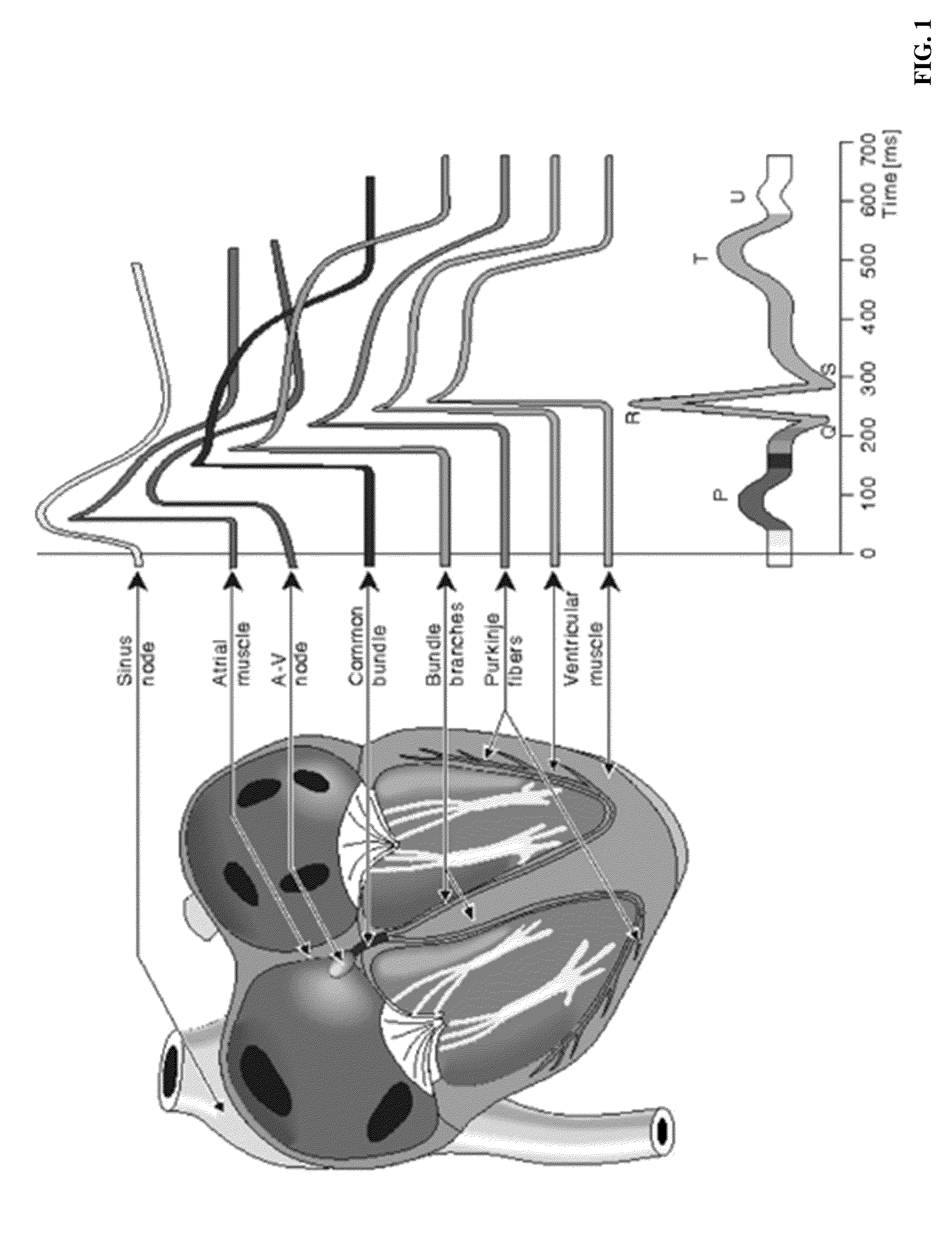 Passive method and system for contact and/or non-contact with or without intervening materials for detection and identification of the incidence, traverse and physiological condition of a living human at any instant