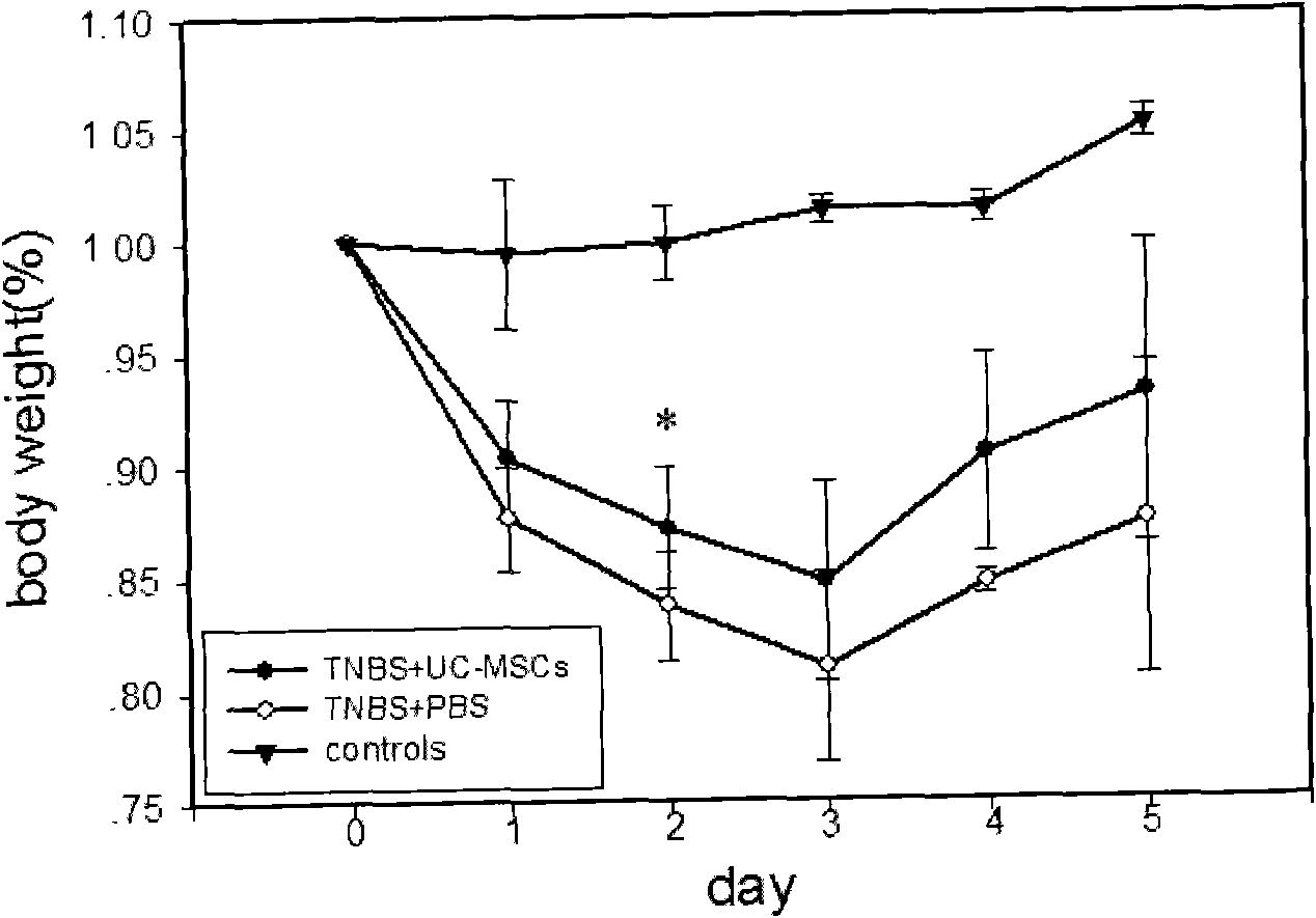 Human Crohn disease-simulating murine colitis model, and preparation method and use thereof