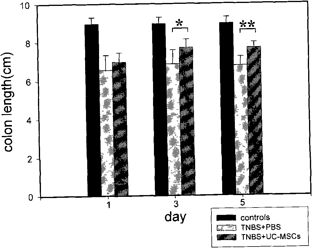 Human Crohn disease-simulating murine colitis model, and preparation method and use thereof