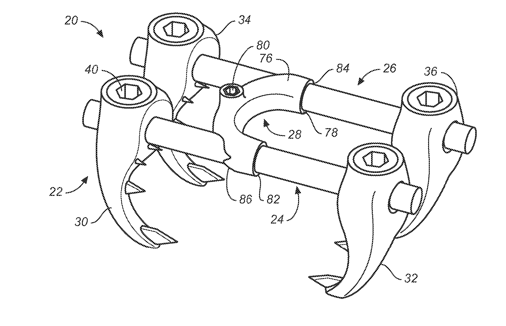 Implant system and method to treat degenerative disorders of the spine