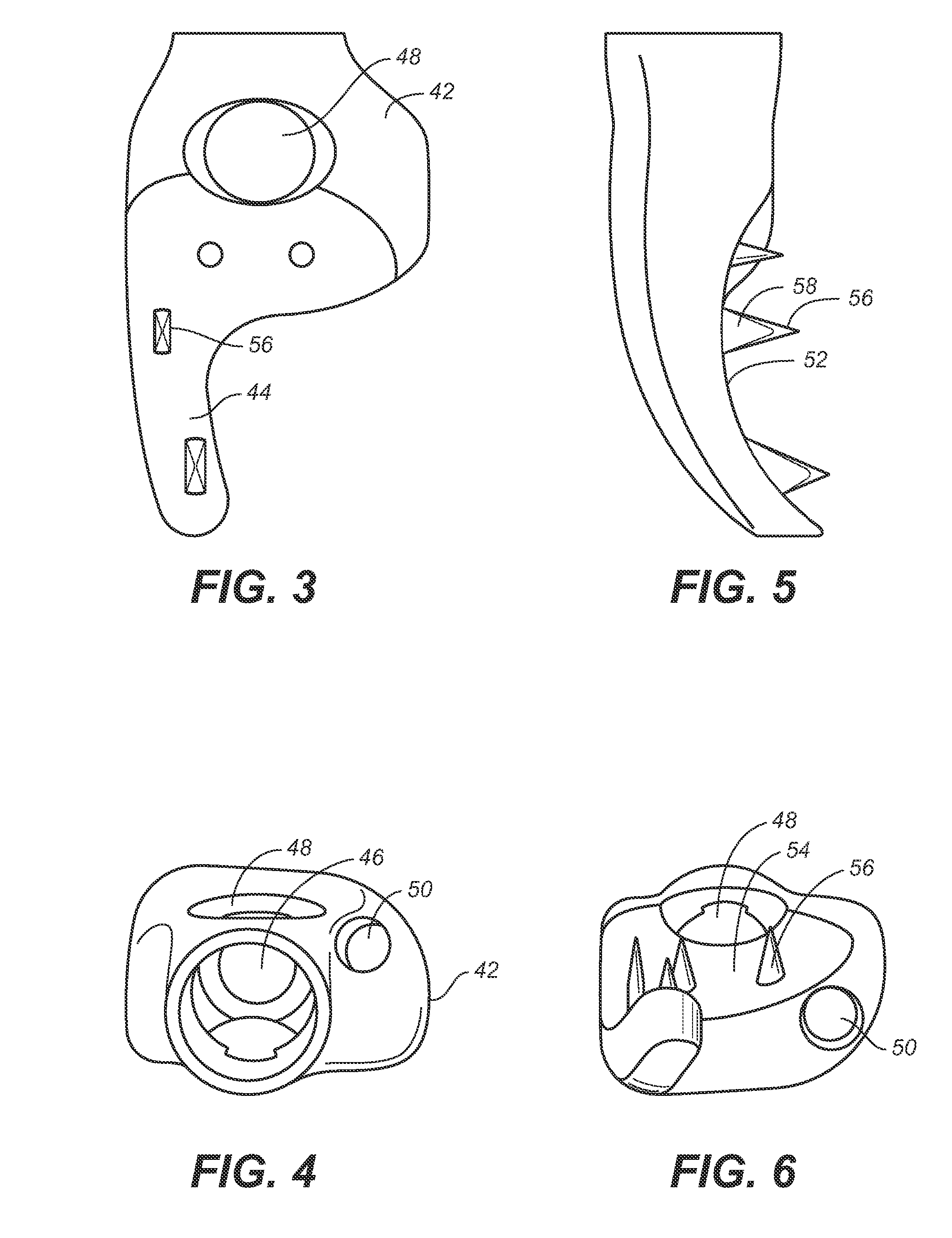 Implant system and method to treat degenerative disorders of the spine