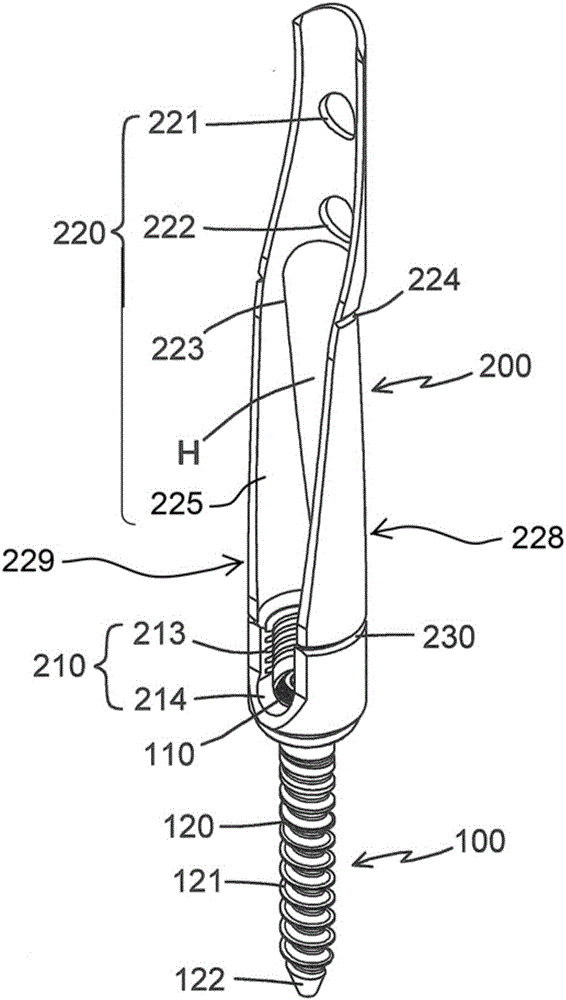 Bone screw and percutaneous minimally invasive pedicle fixation system