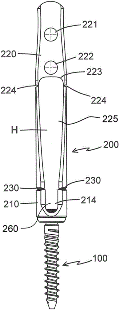 Bone screw and percutaneous minimally invasive pedicle fixation system