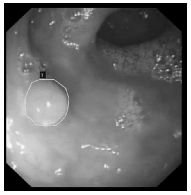 Focus tracking method under digestive endoscope based on sequential feature learning