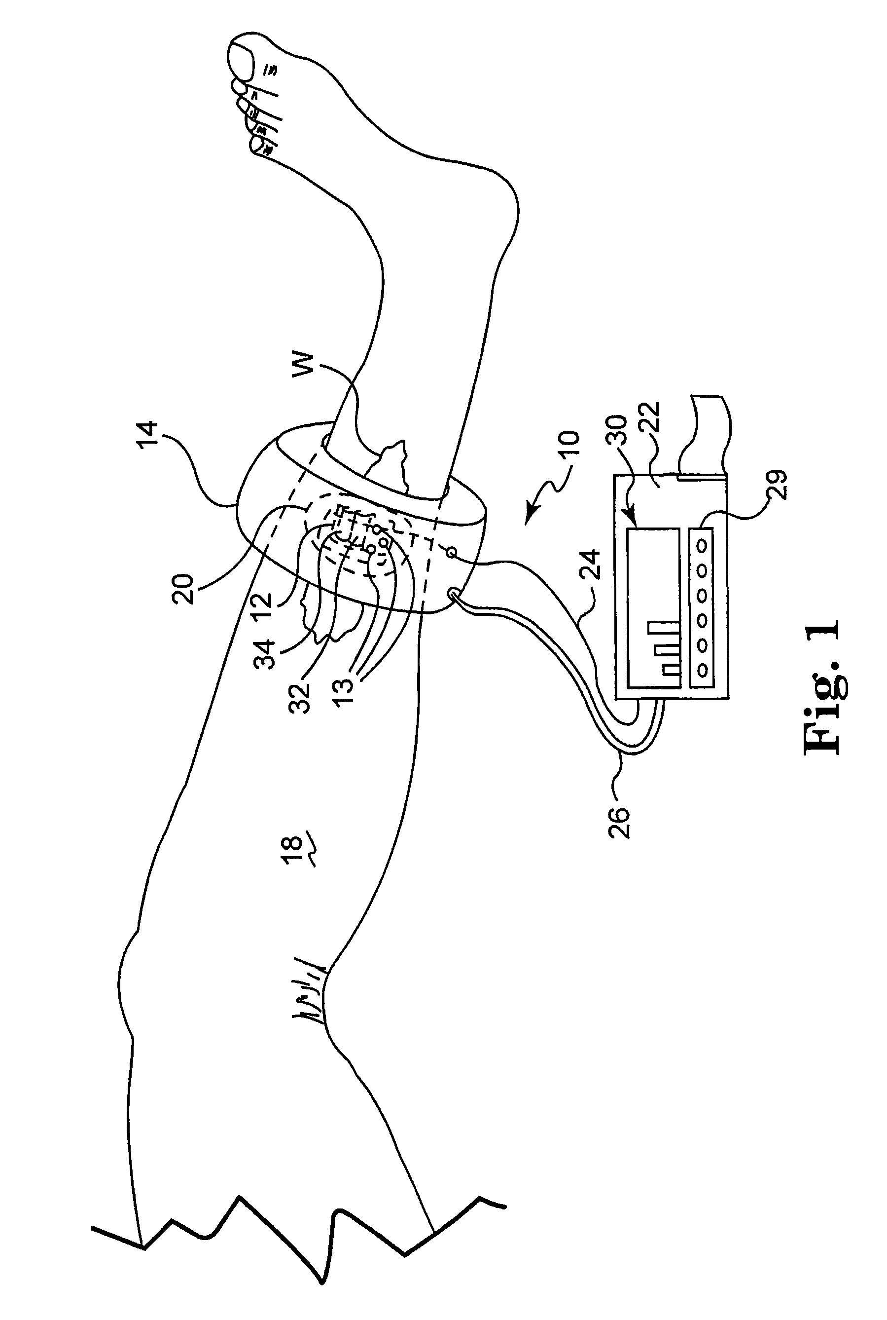 System and method for assessing capillary vitality