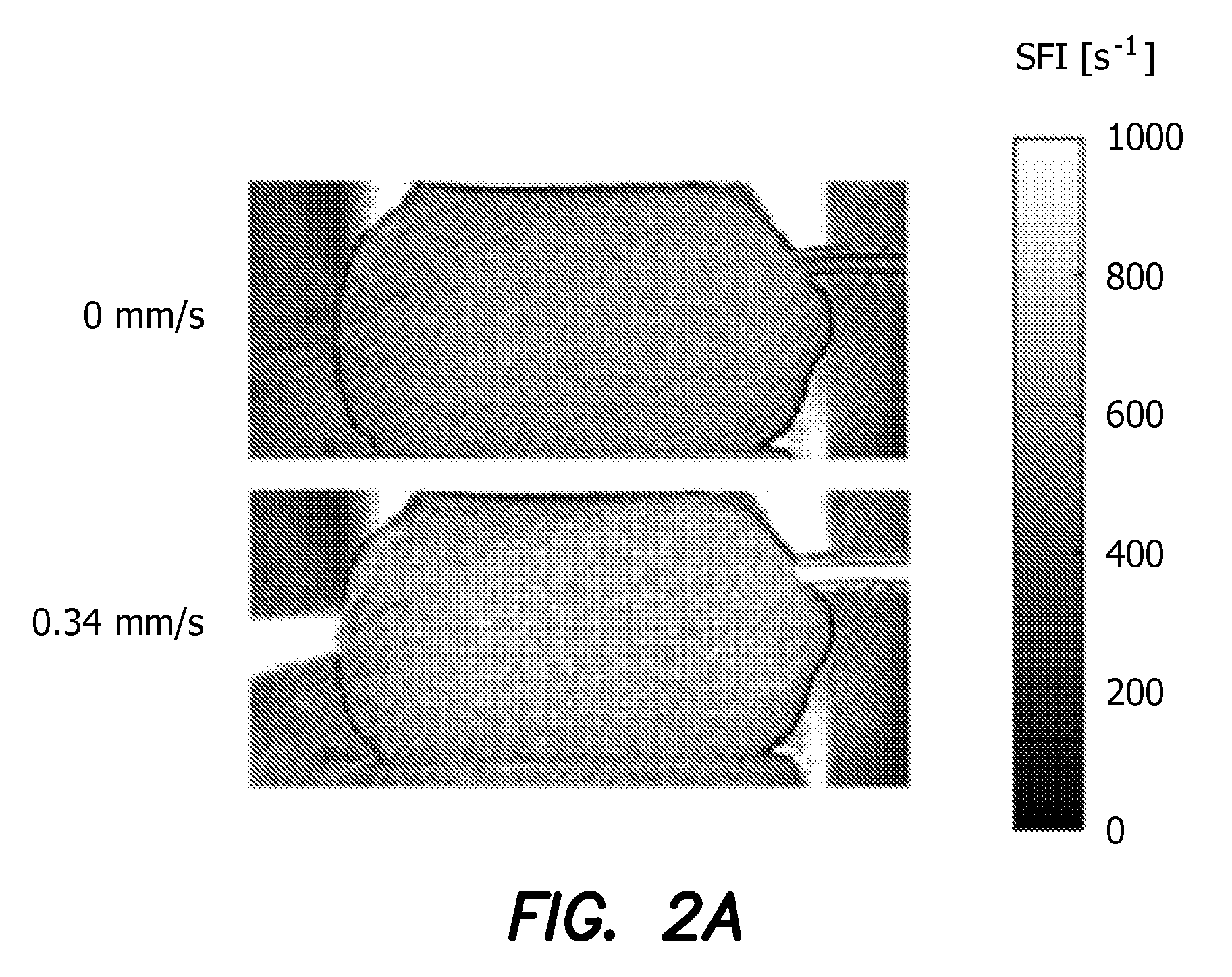 Method and apparatus for the assessment of pulpal vitality using laser speckle imaging