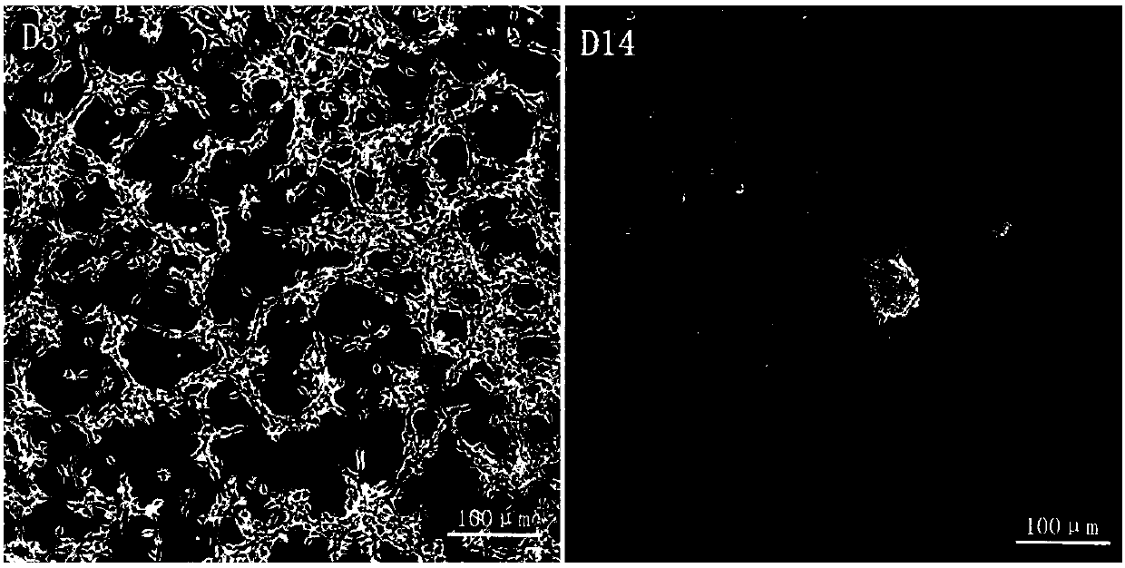 Method for inducing human spinal cord motor nerve precursor cells to differentiate into spinal cord motor neurons