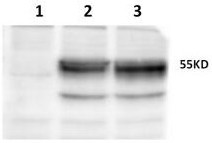 Hybridoma cell line secreting anti-human b7-h4 extracellular monoclonal antibody, anti-human b7-h4 monoclonal antibody and application thereof