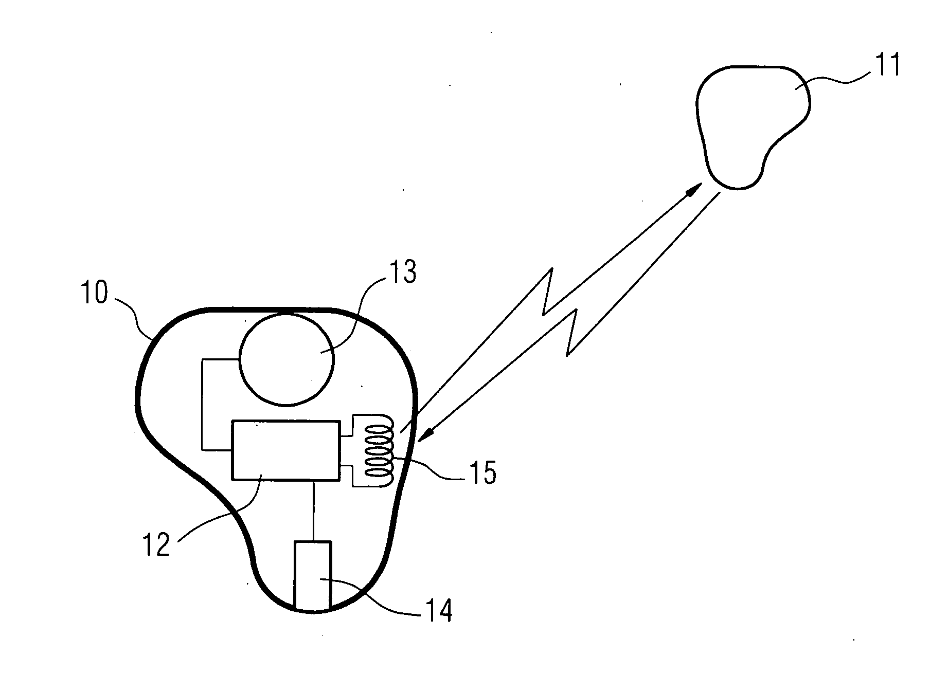 Hearing apparatus with low-interference receiver control and corresponding method