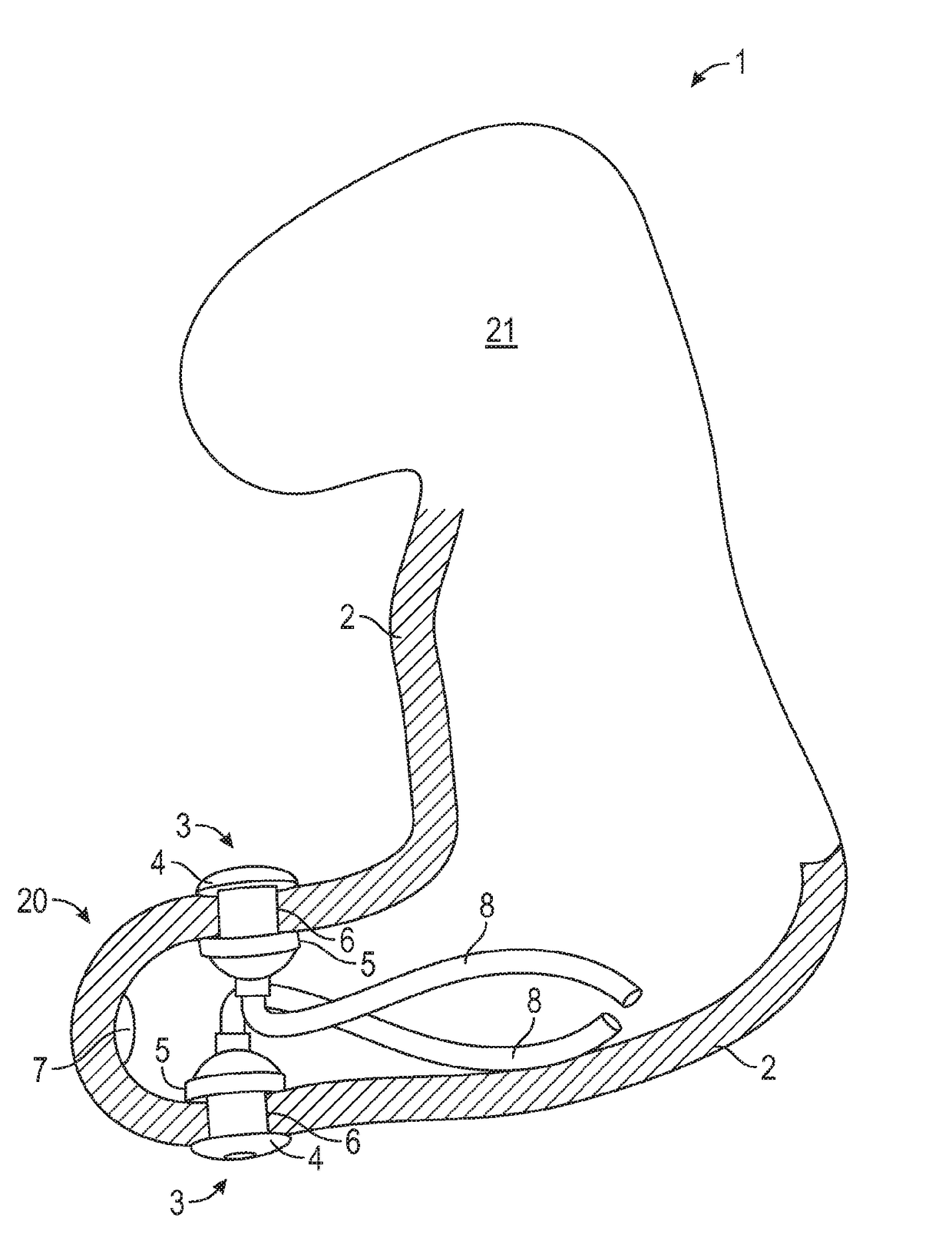 Ear canal plug for detecting bio-electrical signals