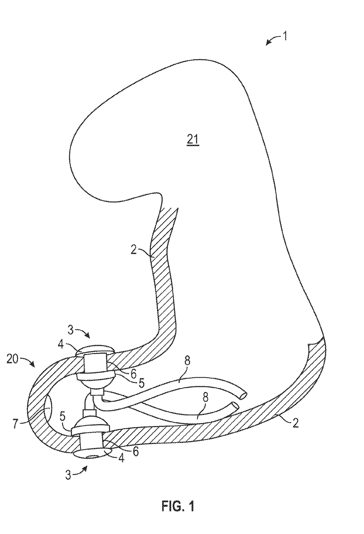 Ear canal plug for detecting bio-electrical signals