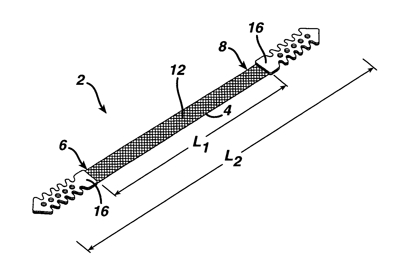 Minimally invasive medical implant and insertion device and method for using the same