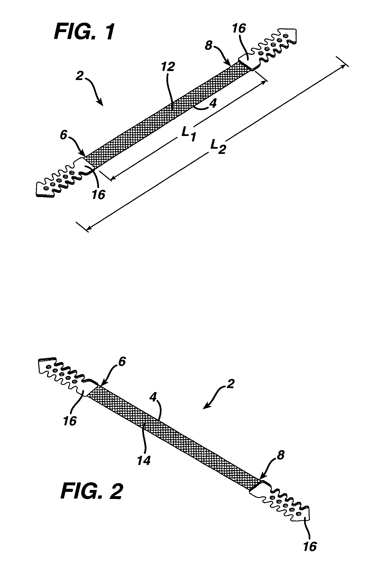 Minimally invasive medical implant and insertion device and method for using the same