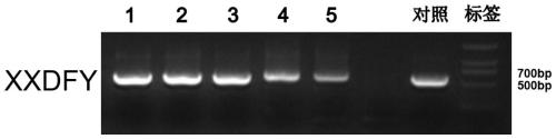 Hepatitis B virus X gene and application thereof