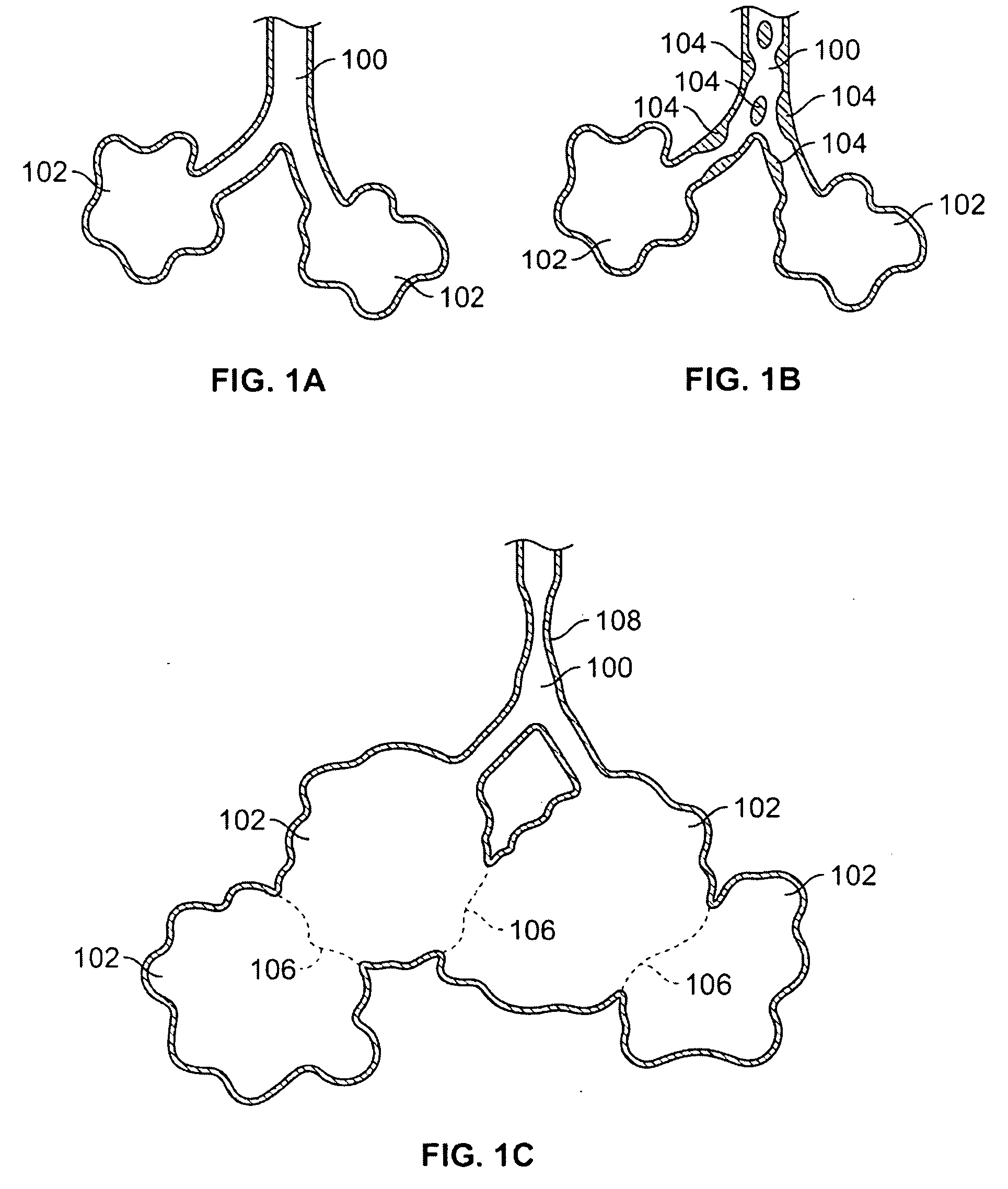 Devices for creating passages and sensing blood vessels