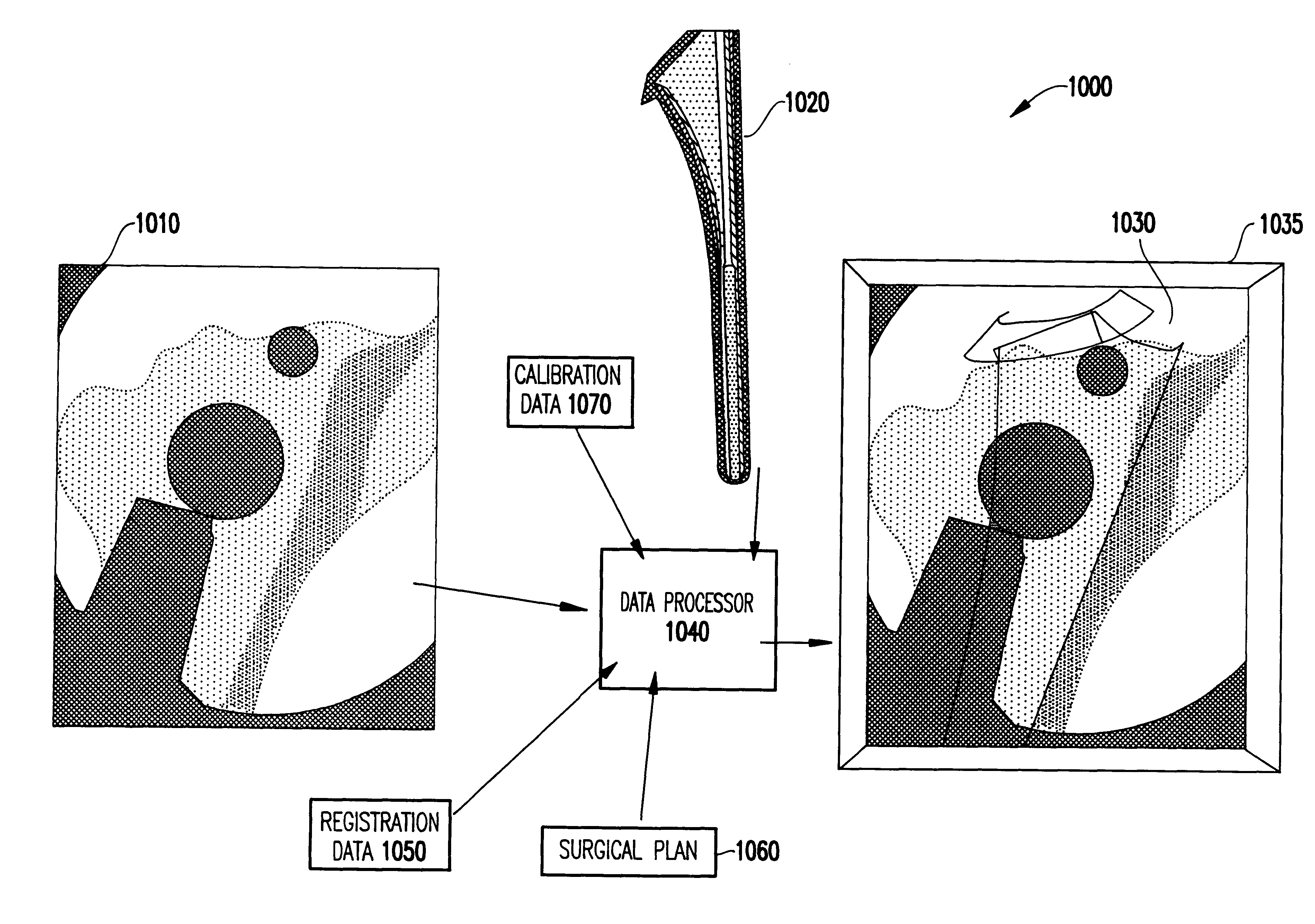 System and method for intra-operative, image-based, interactive verification of a pre-operative surgical plan