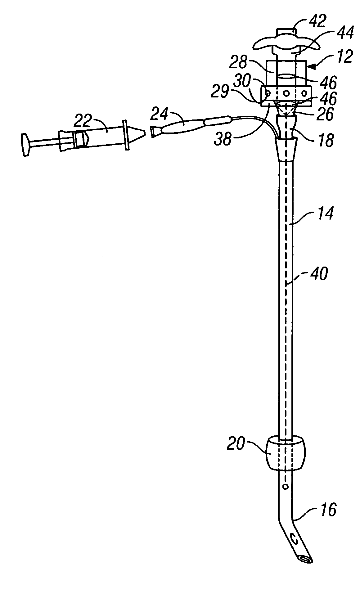 Endotracheal tube system and method of use