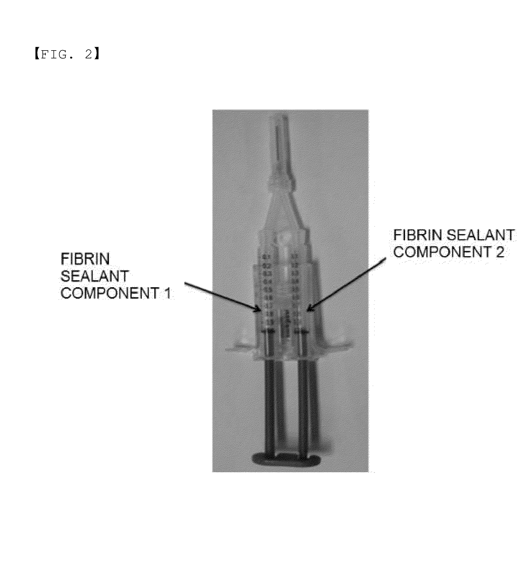 Method for preparing highly concentrated fibrinogen solution and method for preparing fibrin sealant by using thereof