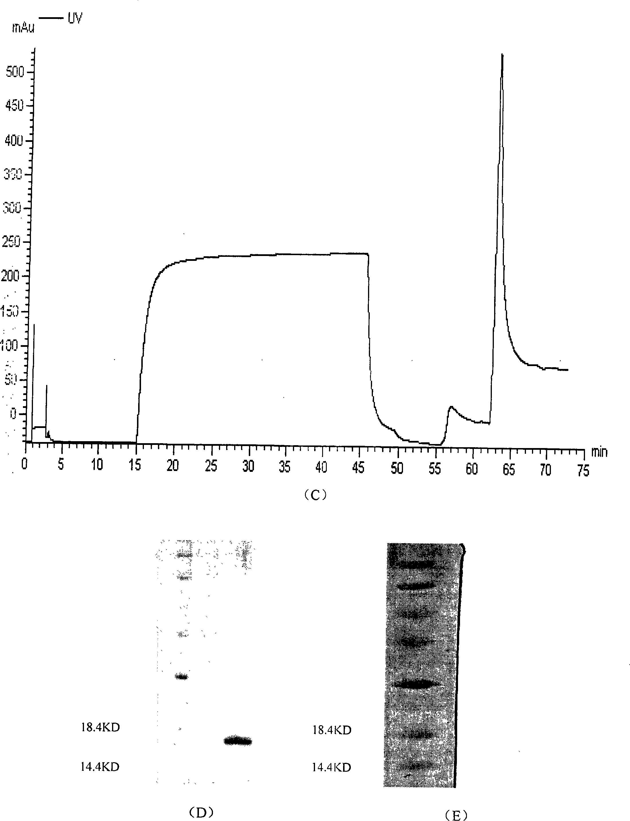 Soluble human program death protein-1-lgV and preparation method thereof