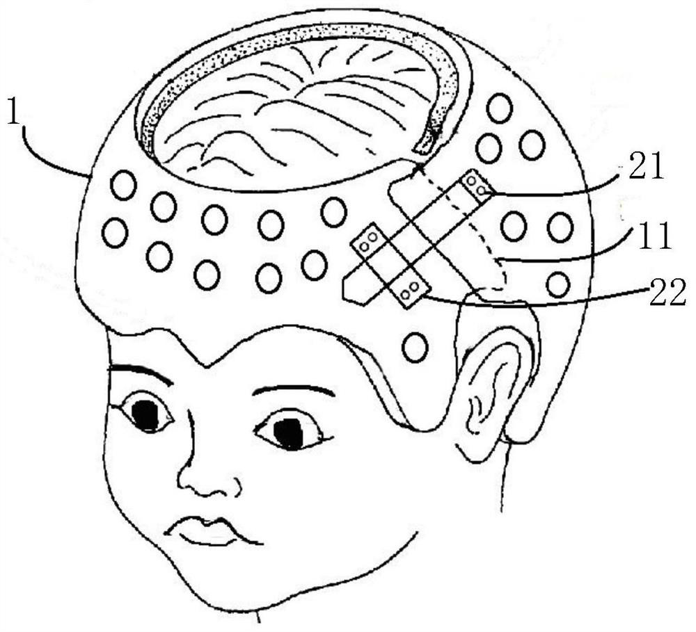 Adjustable structure of orthopedic helmet