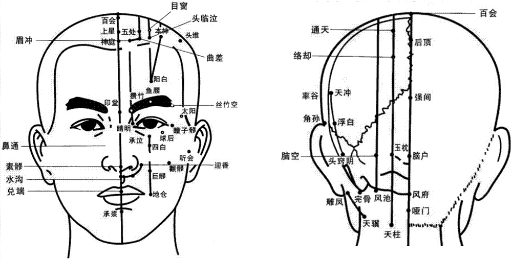 Personalized head-face acupoint recognition model building method and personalized head-face acupoint recognition positioning method and system