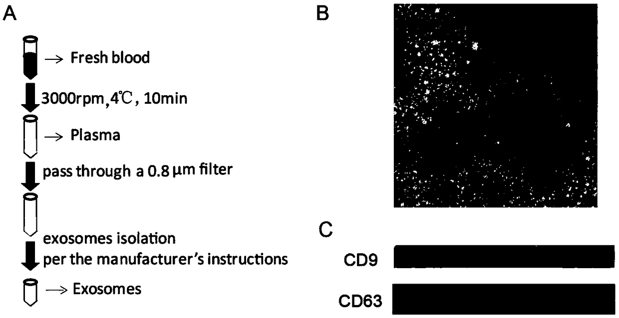 Marker for identifying benign and malignant pulmonary nodules by using exosome protein and application of marker