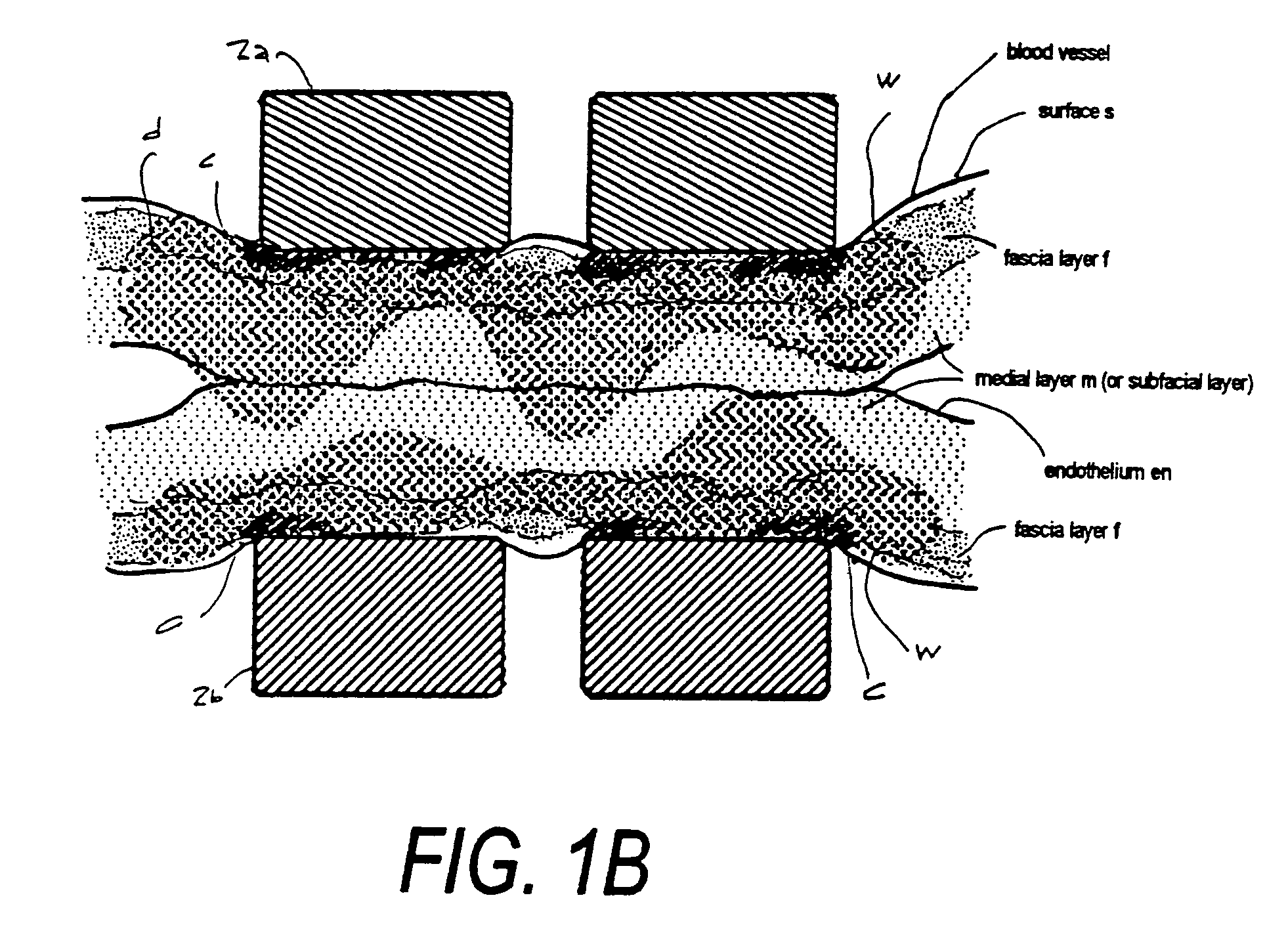 Electrosurgical instrument and method