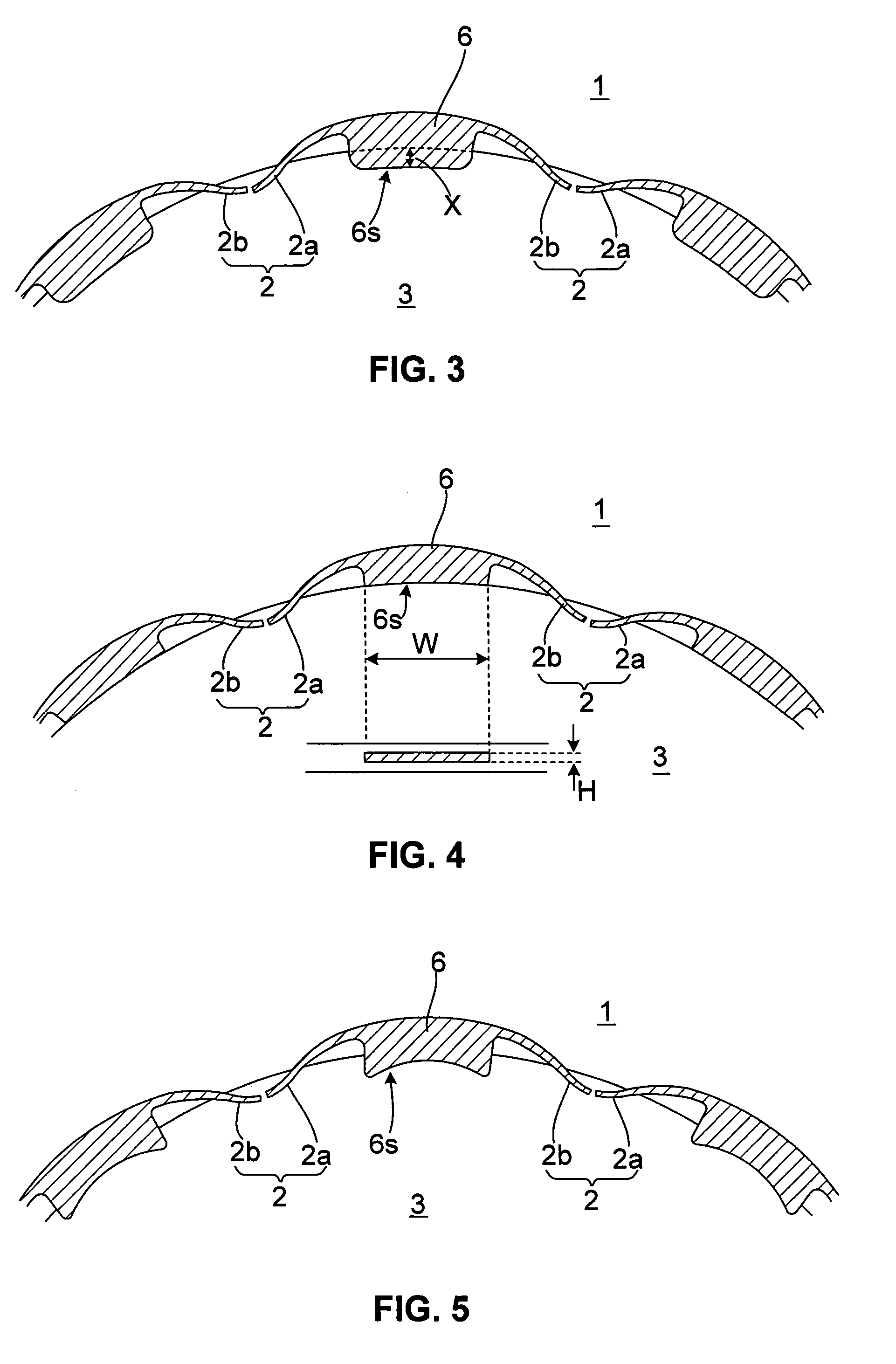 Multipoint ignition device