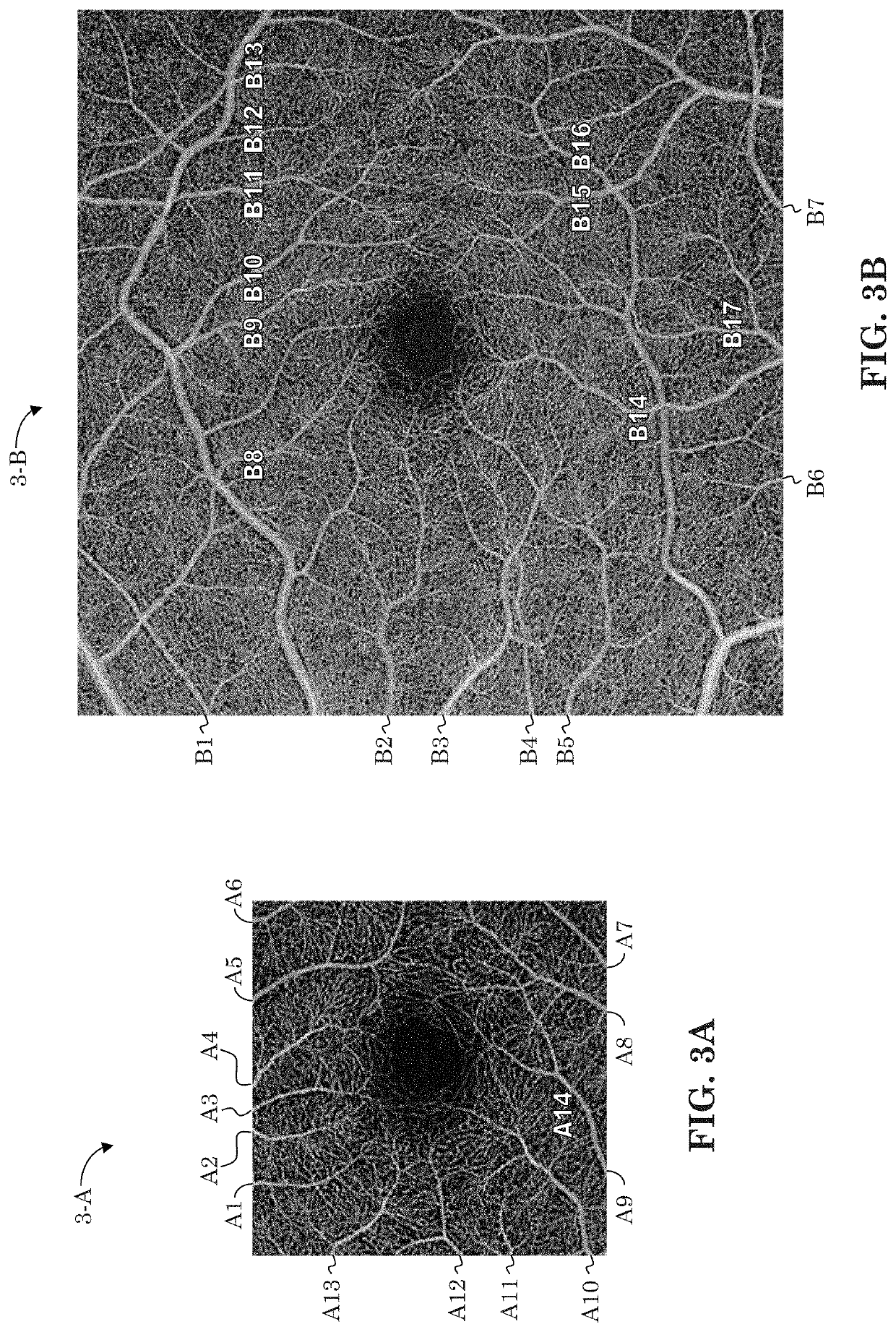 Oct-based retinal artery/vein classification