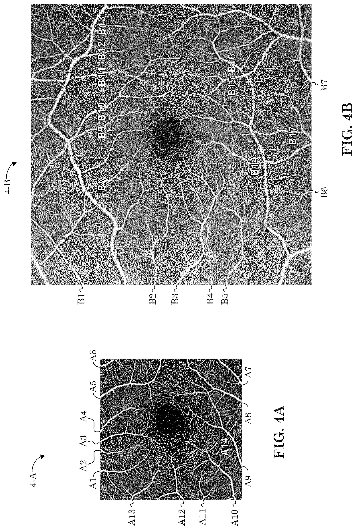 Oct-based retinal artery/vein classification