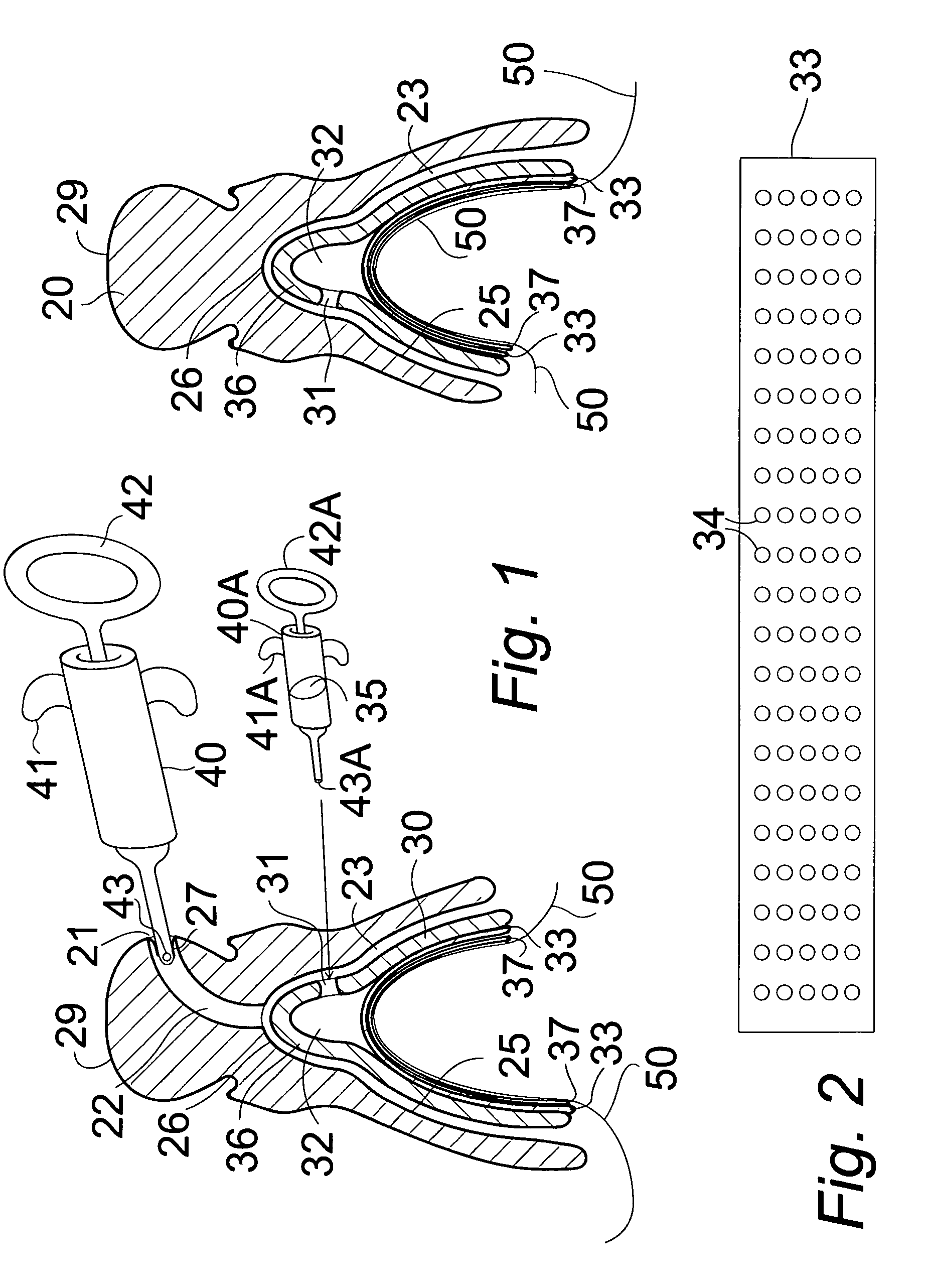 Vacuum-seated dentures with skin contacting plate