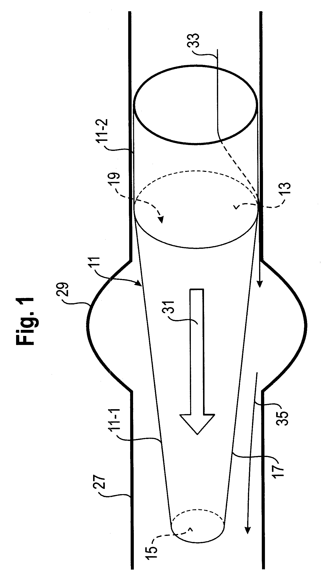 Vessel implant for the treatment of an aneurysm