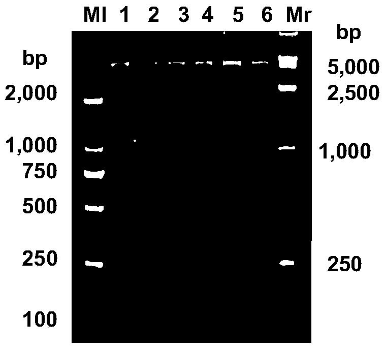 A genetically engineered Staphylococcus aureus phage lyase and its preparation method and application