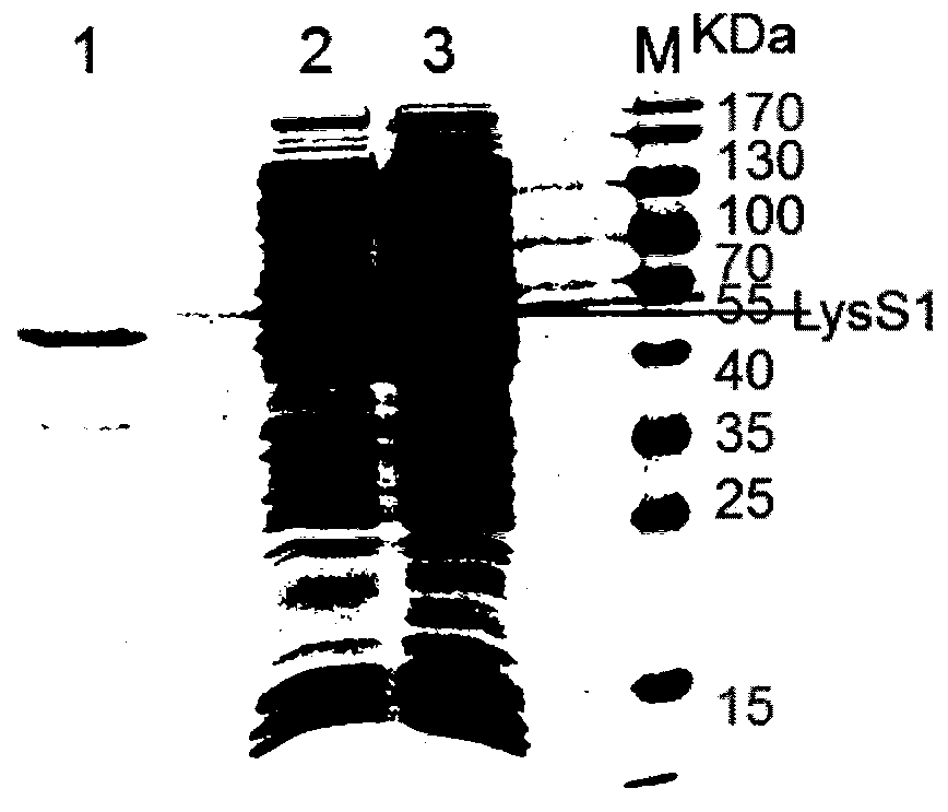 A genetically engineered Staphylococcus aureus phage lyase and its preparation method and application