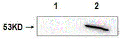 Hybridoma cell strain and rabies virus phosphoprotein monoclonal antibody generated by same