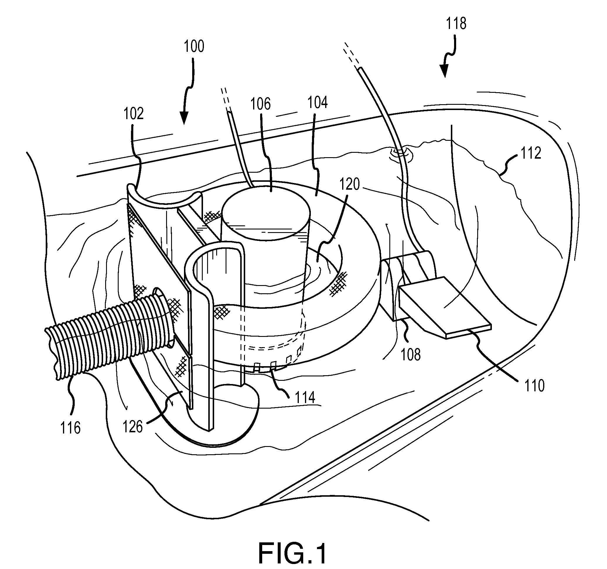 Water Pollution Prevention And Remediation Apparatus