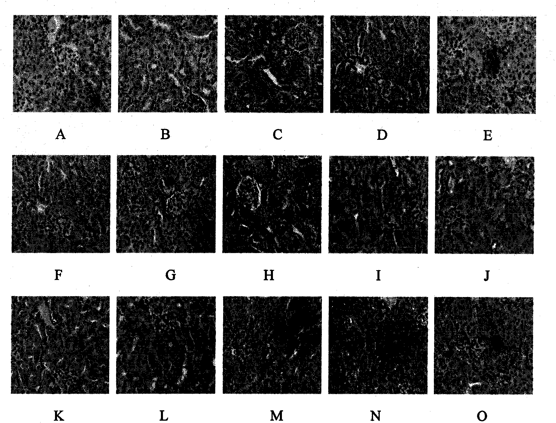 Non-insulin-dependent diabetes mellitus-resisting liriope spicata fructosan and preparation method and application thereof