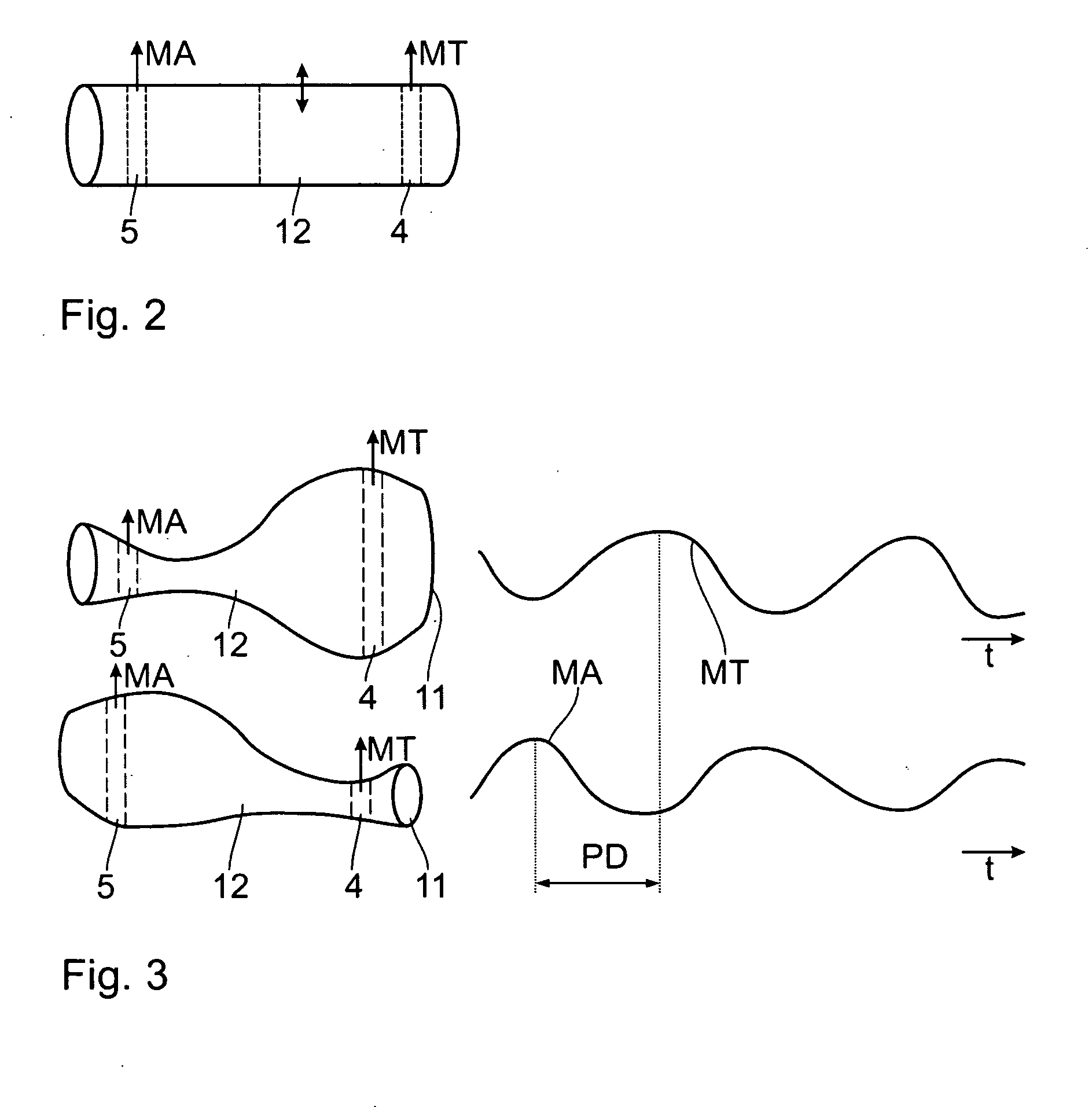 Method and apparatus for respiratory monitoring
